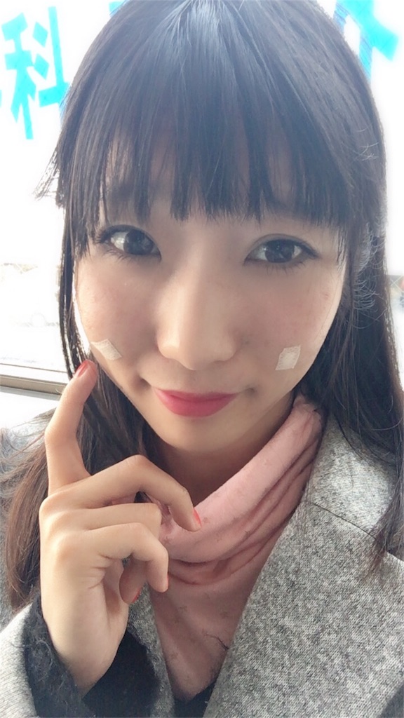 f:id:ReptileNaNa:20180226211404j:image f:id:ReptileNaNa:20180226211404j:image